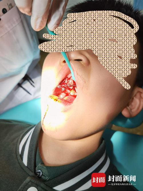 重慶特斯拉車主遭遇驚魂一幕 停車時車輛自動加速撞墻，致孩子受傷